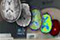 2013 02 25 10 55 52 627 2013 02 26 Hybrid Imaging Shah Pet Mr 20130225185313
