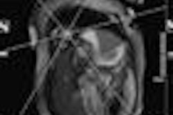 2013 02 26 09 31 46 933 2013 02 26 Card Insider Siemens 20130226163335