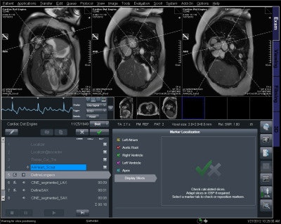 Cardiac axis localization software