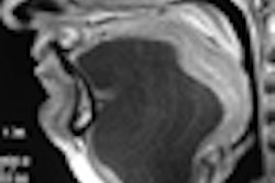 2013 02 28 15 28 28 229 2013 03 07 Head Neck Thumb