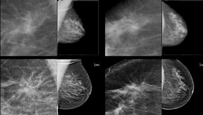 Architectural distortion