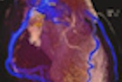 2013 03 04 15 57 46 918 2013 03 07 Cardiac Thumb