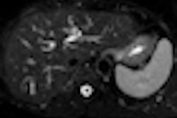 2013 03 07 10 22 40 150 2013 03 07 Colorectal Thumb