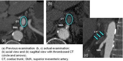 2013 03 07 12 05 25 882 Hohmann missed ct