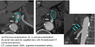2013 03 07 12 05 25 882 Hohmann missed ct