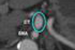 2013 03 07 13 19 23 647 Missed Ct 70