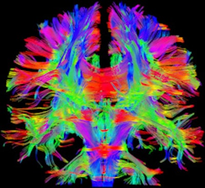 Anatomical details of the brain, knee, and head viewed with the new Magnetom Prisma 3-tesla MRI system. The machine combines high gradient strength and fast gradient slew rates in a way that is unprecedented for commercial whole-body systems worldwide, according to the manufacturer. Images courtesy of Siemens Healthcare.