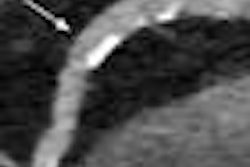 2013 03 10 09 54 04 193 Morsbach patient 20130310165736