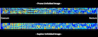 2013 03 11 11 08 32 784 Hampshire Superimpose 450