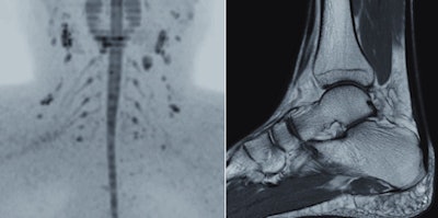 Left: MR image of the posterior triangle of the neck using the DWIBS (diffusion-weighted whole-body imaging with background body subtraction) technique. Right: High-resolution, proton density-weighted image of the ankle. Images courtesy of Philips.