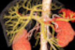 2013 03 14 09 08 01 765 2013 03 13 Hitachi Abdomen 3 D 70