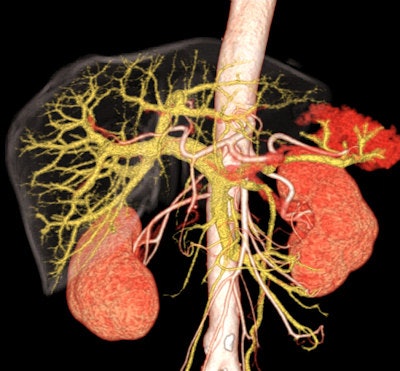 3D reconstructions give the raw data an impressively sculpture-like quality, but they might also undermine the authority of radiologists. Image courtesy of Hitachi Medical Systems.