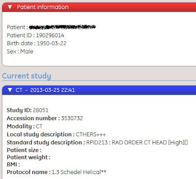 Screenshot of a performed protocol showing a combination of local study description CTBRAIN and acquisition protocol Helical Skull, mapped to RadLex element 213.