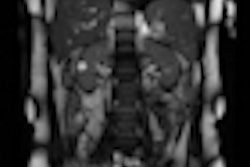 2013 03 29 07 24 12 690 2013 03 29 Mri Kidney Thumb