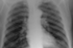2012 02 15 18 04 43 278 2012 02 17 Chest Radiography Thumb
