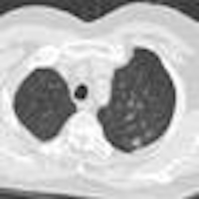 2013 03 09 10 56 47 820 Jacobs example1 20130309180700