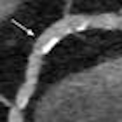 2013 03 10 09 54 04 193 Morsbach patient 20130310165736