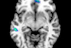 2013 03 29 11 34 56 603 2013 04 01 Pediatric Migraine Thumb