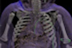 2013 04 08 12 14 16 918 2013 04 09 Autopsies Thumb
