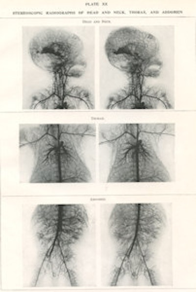 Radiographs