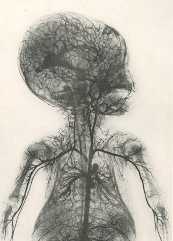 Vessels