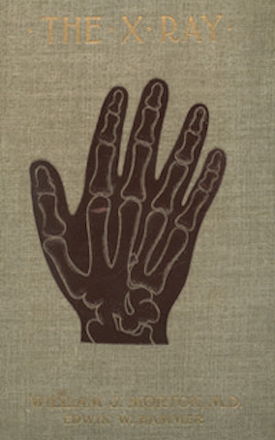 Figure 2: The X-Ray or Photography of the Invisible (William J. Morton).