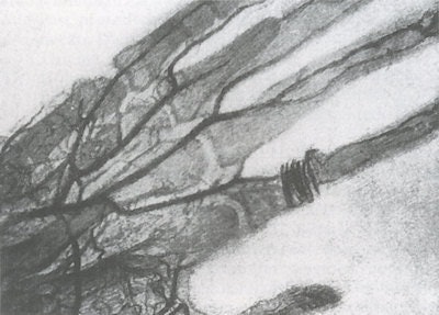 Figure 1: First angiogram by Haschek and Lindenthal, taken in January 1896.