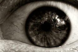 2013 04 22 12 46 30 839 Eye 200
