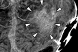 2013 04 30 16 20 40 148 Mip 20130430232353