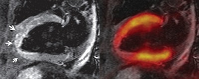 2013 05 08 15 38 21 697 Pet Mri 3c 3d 450