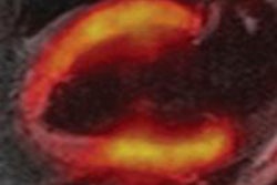 2013 05 08 15 38 21 697 Pet Mri 3c 3d 450 20130508224219