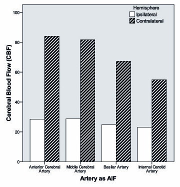 AUCAIF of different cerebral arteries. All images courtesy of Dr. Joris Niesten.