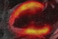 2013 05 13 08 13 40 838 Pet Mri Image D 20130513151434