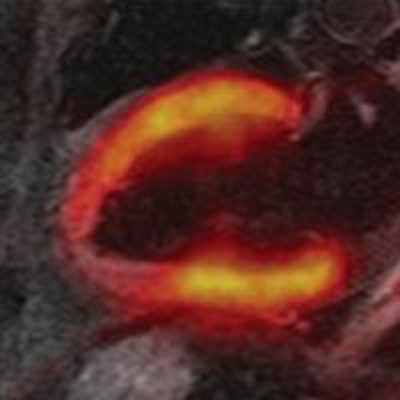 2013 05 13 08 13 40 838 Pet Mri Image D 20130513151434