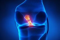 2013 05 13 10 00 46 114 Torn Acl 200