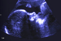 2013 05 21 08 10 12 803 Fetal Ultrasound 200a