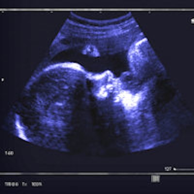 2013 05 21 08 10 12 803 Fetal Ultrasound 200a