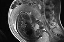 2013 05 31 11 23 19 193 2013 06 03 Fetal Mri 20130531182826