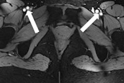 2013 06 04 08 47 30 734 2013 06 03 Female Pelvis Thumb