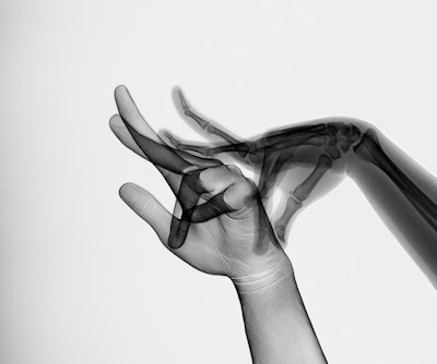 'Skin and bones' from the Hand Plays modified presence series. All images © Marc Ferrante (marcferrante.com).