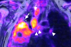 2013 06 25 17 32 30 342 2013 06 26 Kohan Pet Mri 200