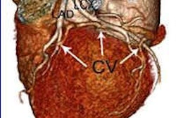 2013 06 26 12 13 51 197 2013 06 27 Ccta Thumb