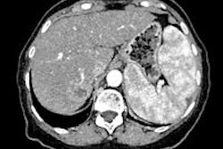 2013 07 01 12 57 49 626 2013 07 02 Hcc Thumb