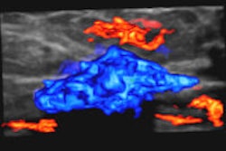 2013 07 09 11 23 27 118 2013 07 10 Elastography