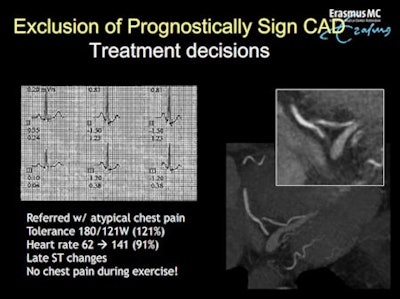 A 62-year-old man presenting with stable chest pain showed significant stenosis at CCTA in the posterior descending artery, and was not revascularized. All images courtesy of Dr. Koen Nieman, Erasmus University Medical Center.