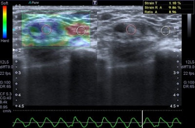 elastography''