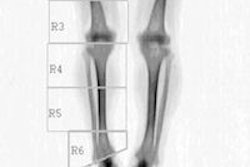 2013 07 11 14 18 57 119 2013 07 12 Dexa 200