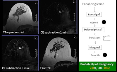 An example of a typical benign case using the classification tree. All images courtesy of Dr. Pascal Baltzer.
