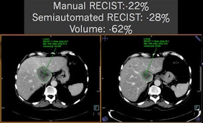 Manual vs. semiautomated RECIST