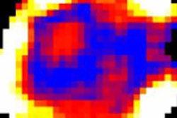 2013 07 17 12 54 28 592 2013 07 17 Mri Glucocest 18july13 20130717201904